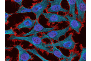 خلايا سرطان عنق الرحم