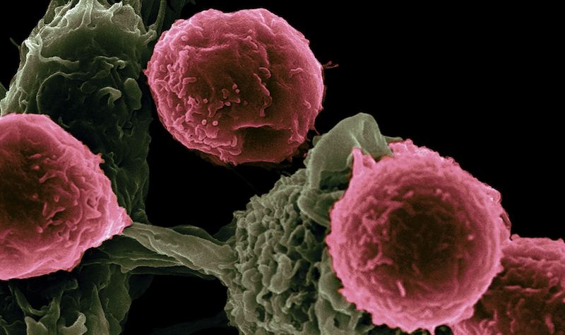 ما هي أنواع السرطان dostarlimab تستخدم ل؟ النظرة العامة الوحيدة التي تحتاجها.